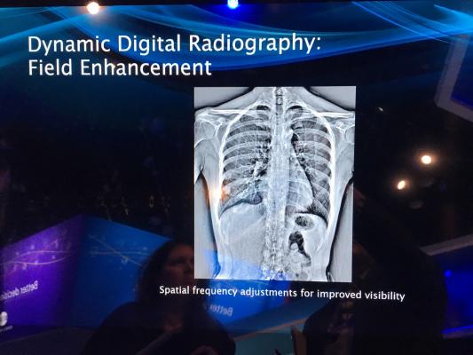 Konica Minolta and Shimadzu to Co-market Dynamic Digital Radiography in the U.S.