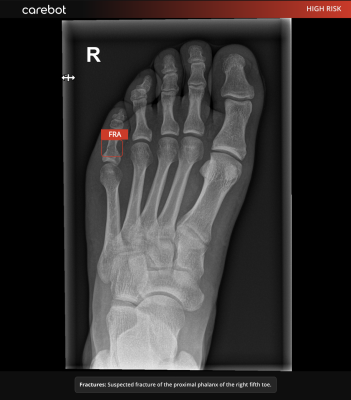 Carebot to Develop Next-Gen AI assistant MSK X-rays