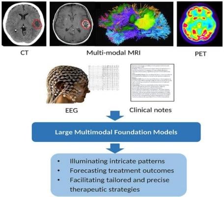 Large multimodal foundation model for radiation oncology