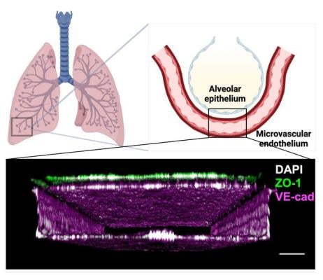 Human life-like in vitro model of radiation damage sustained to the lung opens an unprecedented window into the early disease process, and opportunities for drug development 