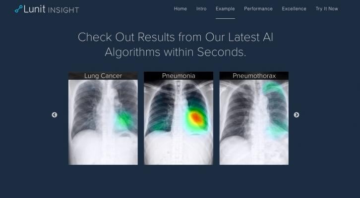 Lunit Insight Offers Cloud-Based AI Analysis for Chest X-rays