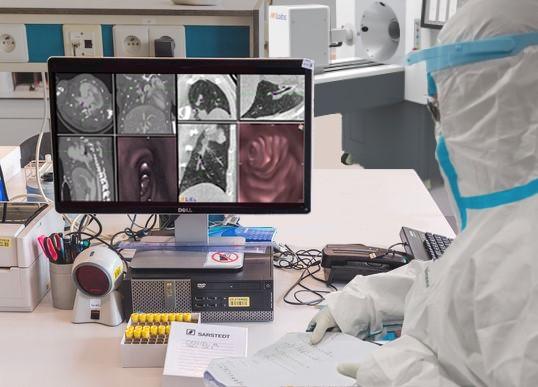 In the light of the coronavirus outbreak, MILabs has enhanced its line of high-performance CT scanners to even better detect the disease #COVID19 #Coronavirus #2019nCoV #Wuhanvirus #SARScov2