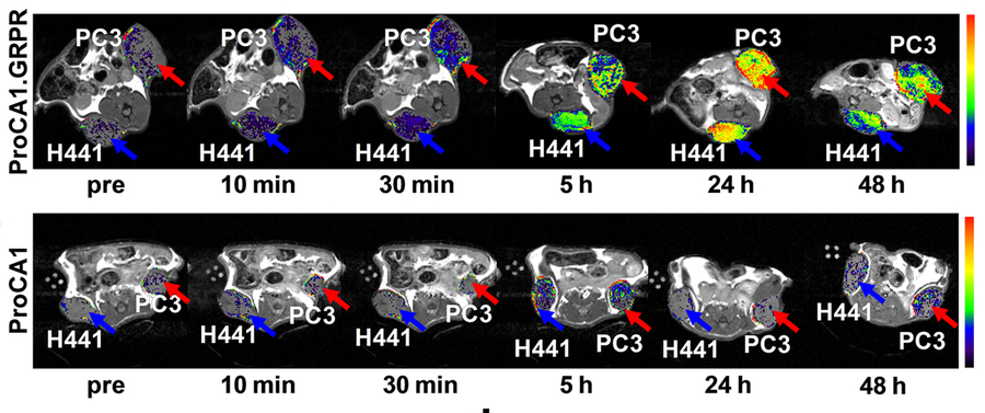 Novel MRI Imaging Agent More Effectively Monitors Impact of Treatment in Lung, Prostate Cancers