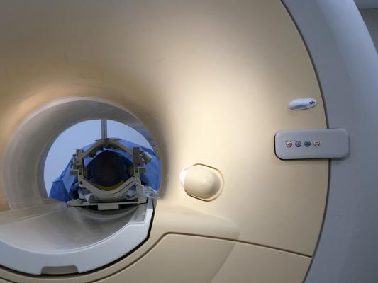 Delta T1 Maps Provide Quantitative, Automated Solution to Assess Brain Tumor Burden