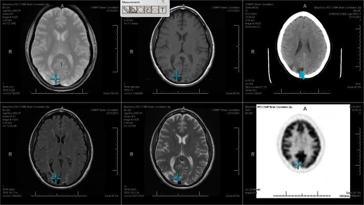 Machine Learning Techniques Generate Clinical Labels of Medical Scans