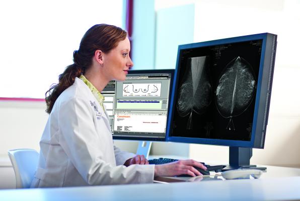 mammography screening, average risk women, age 50, biennial, Georgetown