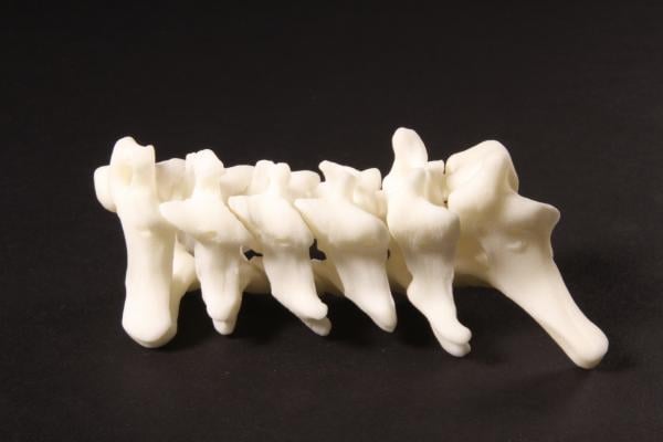 Materialise and Carestream Deploying Zero-Footprint Surgical Planning Solution