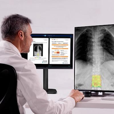 Medimaps Group to Premier AI Software for X-ray Scans at RSNA 2025