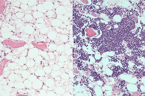 Drug Accelerates Blood System's Recovery After Radiation, Chemotherapy