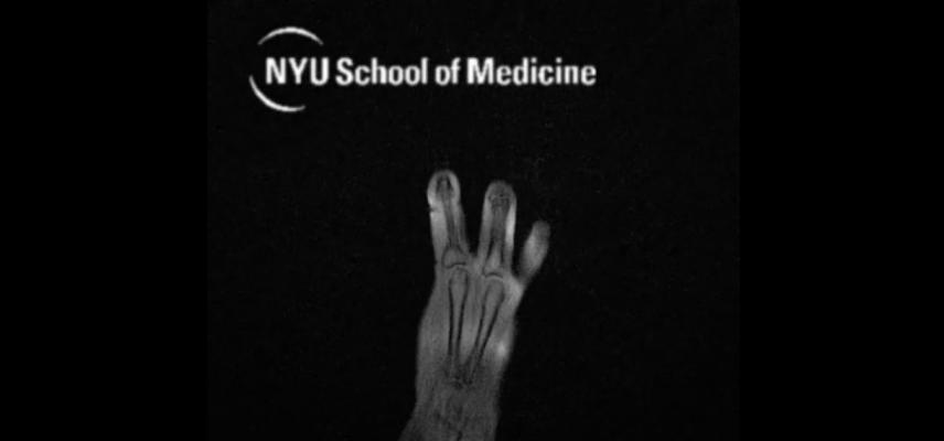 MRI "Glove" Provides New Look at Hand Anatomy