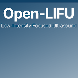 focused ultrasound