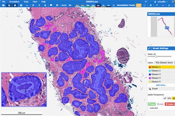 Paige Announces Clinical-grade Artificial Intelligence in Pathology