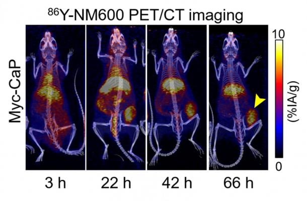 PET/CT imaging showing uptake and retention of 86Y-NM600 (imaging agent) in immunocompetent mice bearing prostate tumors. PET imaging data was employed to estimate tumor dosimetry and prescribe an immunomodulatory 90Y-NM600 (therapy agent) injected activity. Image courtesy of R Hernandez et al., University of Wisconsin-Madison, WI.