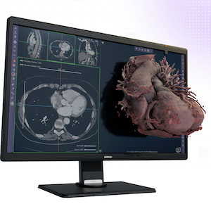 3-D software, medical image processing