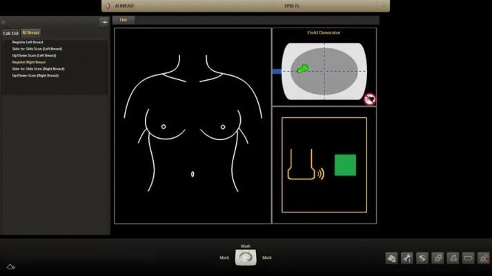 Philips Debuts Integrated Breast Ultrasound Solution