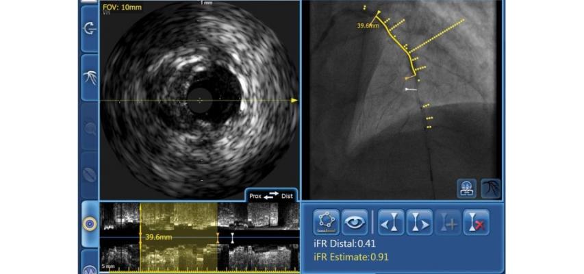 Philips Showcases Integrated Solutions for Cardiovascular Care at TCT 2018