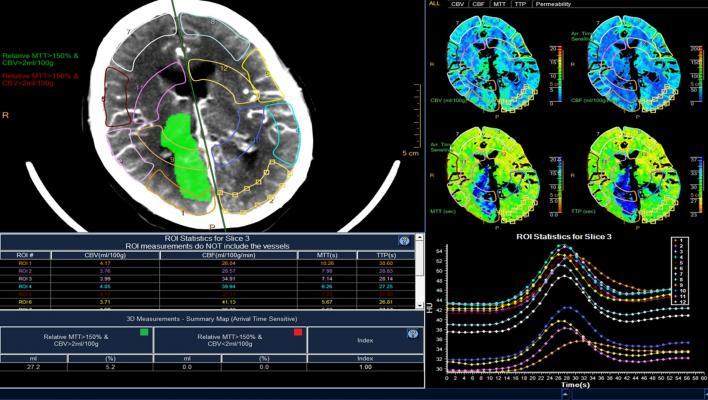 Philips Introduces IntelliSpace Enterprise Edition for Radiology