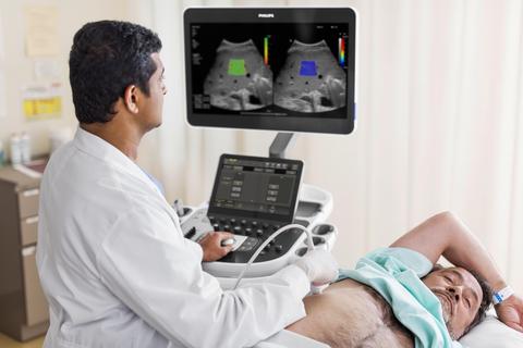 Philips to Invest in Manufacturing, R&D in the U.S. to Expand Production of AI-powered Health Technology 