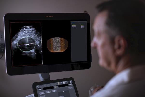 The Philips AAA Model integrates software and Philips 3-D ultrasound technologies into a single solution to automatically segment and quantify the size of the aneurysm sac for surveillance of known native and post-EVAR treated AAAs.