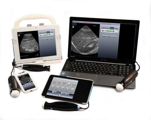 Ultrasound Technology, USB probes, MobiUS PE, MobiUS TC2, UltraLinq