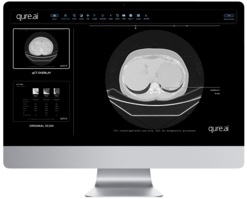 Qure.ai announced that its solutions were awarded the CE Class IIb certification for medical devices under the European Union Medical Device Regulation (Regulation (EU) 2017/745) (EU-MDR). 