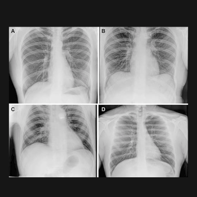 Flight Crew Captures Diagnostic X-rays in Space