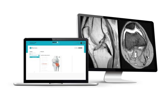 RadioReport, the innovative software for reporting radiological findings, is now available for radiologists in the U.S. Several German practices and clinics are already using RadioReport. 