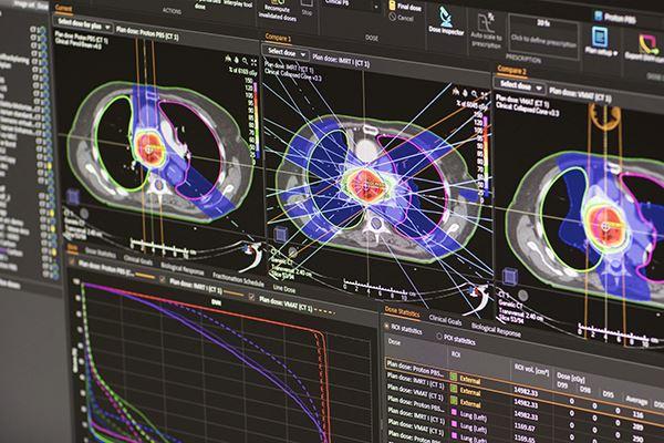 RaySearch Laboratories AB (publ) announces that Sunnybrook Health Sciences Centre – Odette Cancer Centre in Toronto, Canada, has placed an order for RayStation treatment planning system.