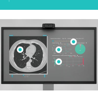 RevealDx Receives MDR Certification for RevealAI-Lung