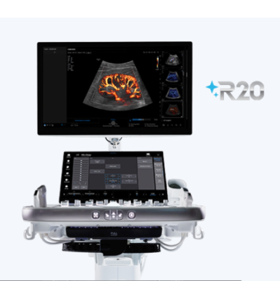 Samsung to Introduce New Ultrasound System at RSNA 2025