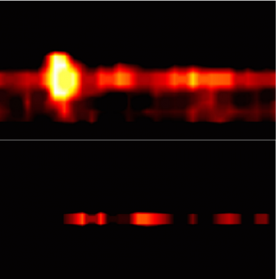 photoacoustic imaging