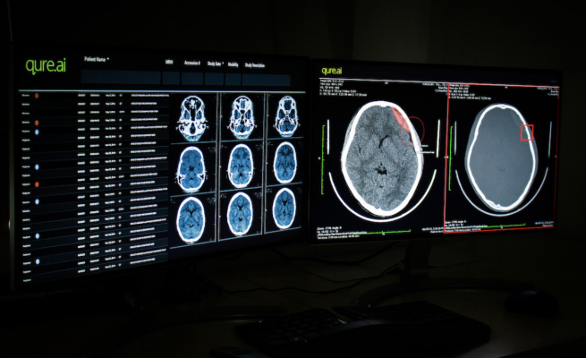 Imaging Artificial Intelligence (AI) provider Qure.ai announced its first US FDA 510(k) clearance for its head CT scan product qER. The US Food and Drug Administration's decision covers four critical abnormalities identified by Qure.ai's emergency room product.