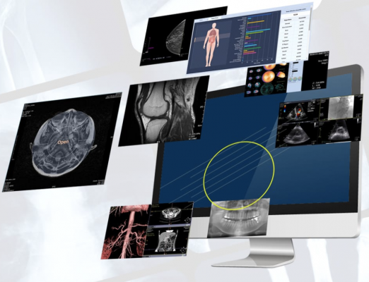 Infinitt has added a Digital Pathology Solution and a Radiation Therapy PACS to its product offerings