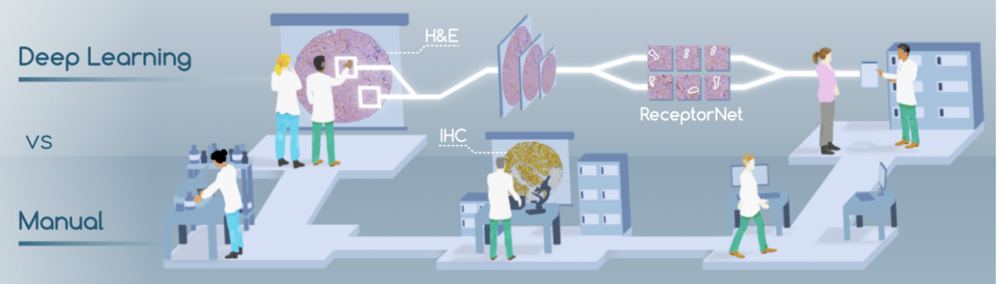 Published in Nature Communications, ReceptorNet is a breakthrough deep-learning algorithm that can determine hormone-receptor status - a crucial biomarker for clinicians when deciding on the appropriate treatment path for breast cancer treatment