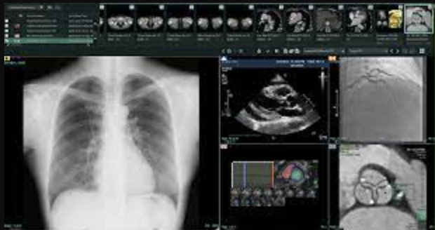 #HIMSS21 #PACS #VNA #mammography FUJIFILM Medical Systems U.S.A., Inc. will showcase Synapse 7x, the company’s next-generation PACS image visualization platform, which unites radiology, mammography, cardiology and enterprise imaging through a single, zero-footprint PACS viewer