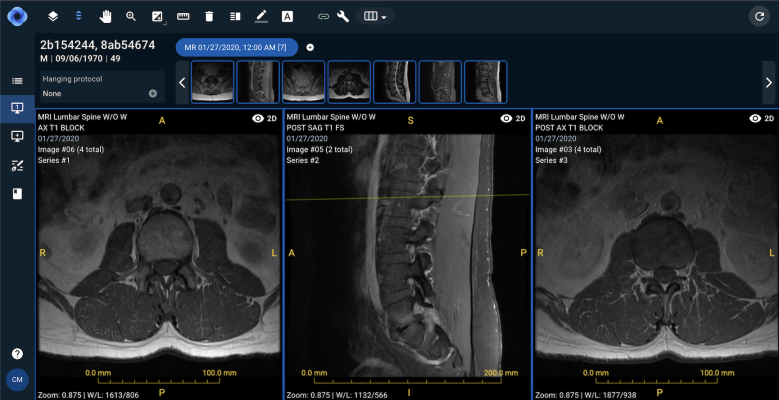 The investment, led by GreatPoint Ventures, will fuel the commercialization of Sirona’s platform, poised to transform radiology IT