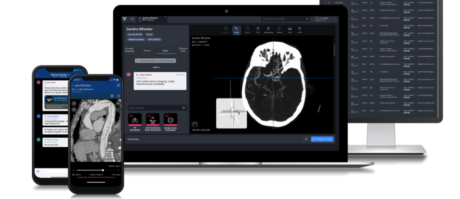 The new algorithm uses AI to detect suspected cerebral aneurysms, enabling hospital systems to ensure that once detected, patients are captured and the aneurysm workflow across an entire health system is standardized.