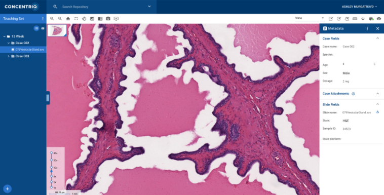 Proscia, a leader in digital and computational pathology solutions, and Hamamatsu Photonics K.K., a leading provider of whole slide imaging systems, announced a collaboration to accelerate digital pathology adoption at an enterprise scale.