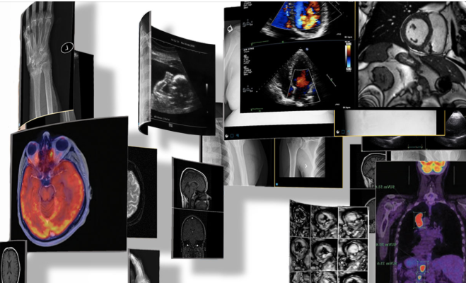 Intelerad Medical Systems, a global leader in medical image management solutions, announced today the launch of its new Enterprise Imaging and Informatics Suite at the 2022 HIMSS Global Health Conference & Exhibition in Orlando, Fla, March 14-18.