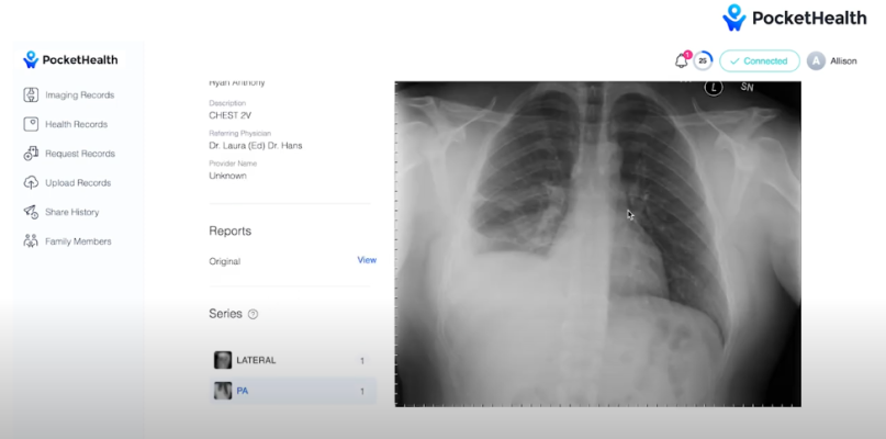 Patient-centric medical image sharing platform PocketHealth announced the launch of Report Reader. 