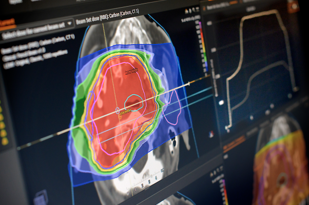 GE Healthcare is proud to announce that it has entered into an agreement to collaborate with RaySearch Laboratories AB, a leading radiation oncology software provider, to develop a new radiation therapy simulation and treatment planning workflow solution, designed to simplify how radiation will be targeted to shrink a tumor.