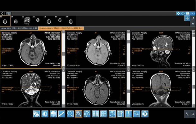 New solutions in combined Windows and Mac/Linux-based portfolios deliver more productivity and cost-savings for medical imaging customers  