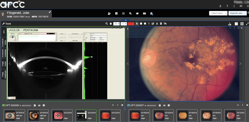 arcc v10.7, Apollo’s newest Enterprise Imaging platform release, enhances a side-by-side clinical image comparison mode to streamline clinical workflow 