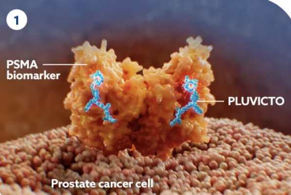 A supply problem with Pluvicto [177Lu-vipivotide tetraxetan; Novartis], the radiopharmaceutical used to treat metastatic prostate cancer, has led to shortages resulting in a delay of 3 months or longer for new patients