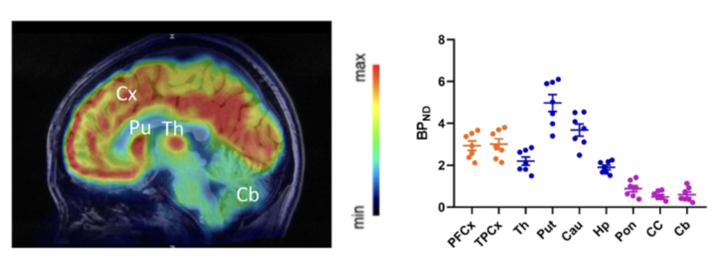 A new PET radiotracer that visualizes the enzyme primarily responsible for metabolic cholesterol degradation in the brain has been successfully validated