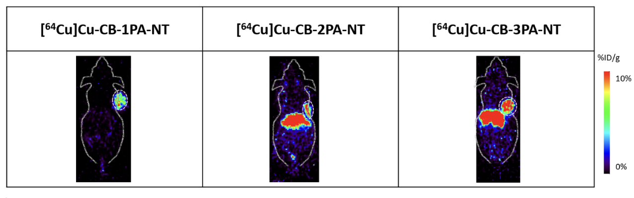 A newly discovered radionuclide-based agent (CB-2PA-NT) has been shown to have high tumor uptake, sustained tumor retention, and high contrast in preclinical models, making it a prime candidate for a novel theranostics approach
