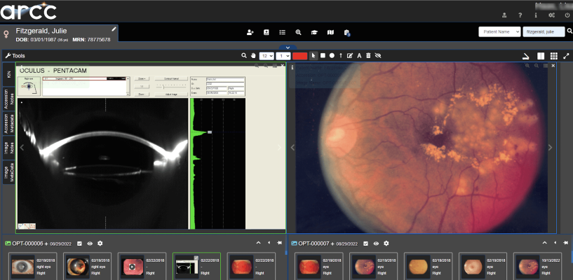 Apollo will preview the new version and cloud-hosted clinical imaging workflow capabilities of its multi-disciplinary medical imaging platform, arcc,