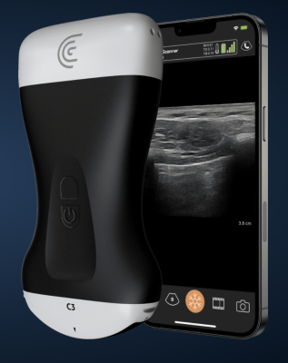 Clarius specialized wireless ultrasound scanners now available on national group purchasing agreement to over 4,350 Health Systems and Hospitals and 300,000 other healthcare providers.   