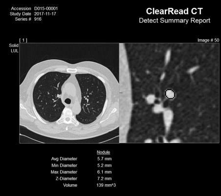 The U.S. Department of Veterans Affairs has selected Riverrain’s ClearRead CT AI-powered technology as part of its Lung Precision Oncology Program.  