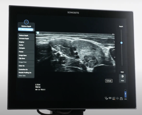 Now available with the Sonosite PX and Sonosite LX point of care ultrasound systems, the feature is designed to streamline workflow and prioritize sterility 